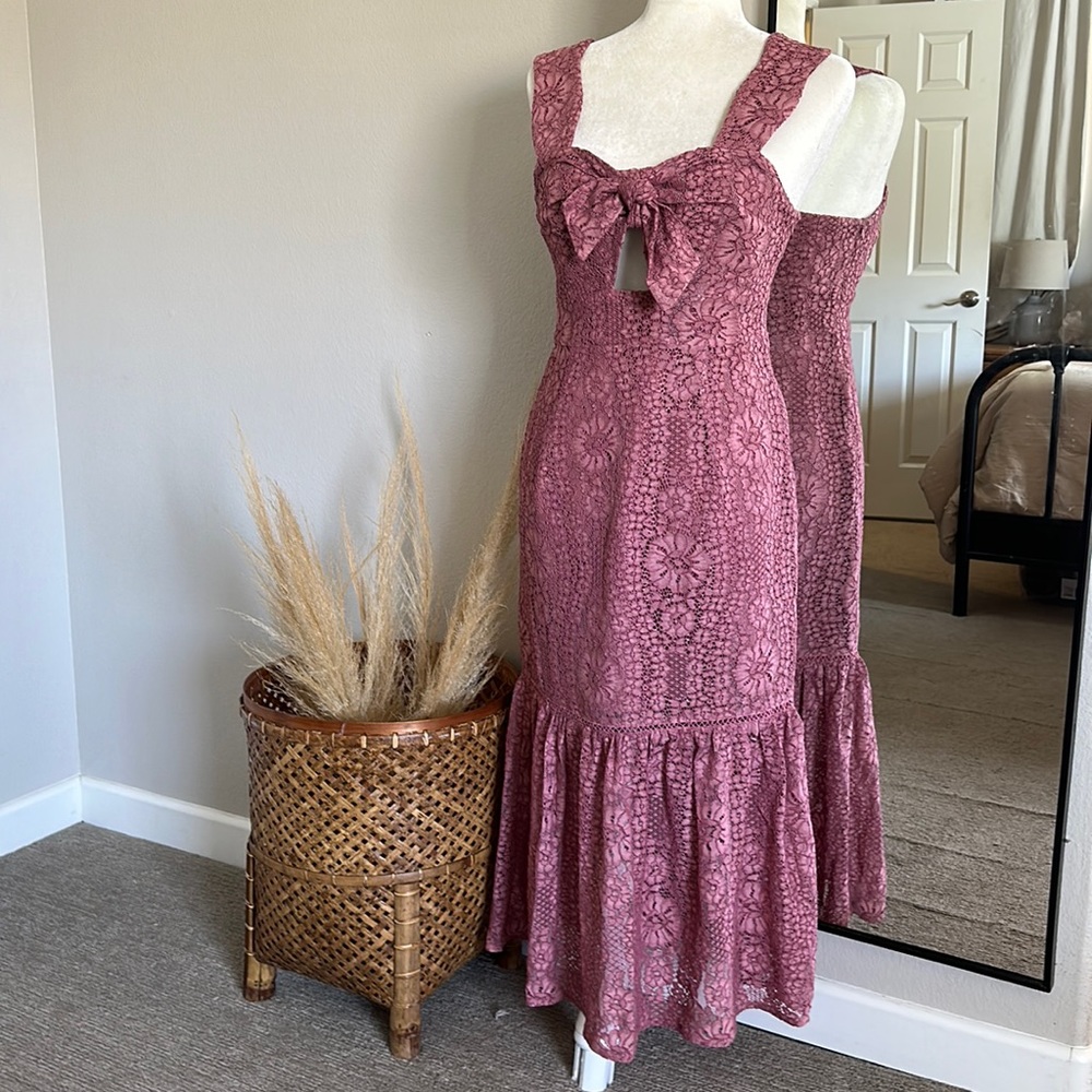 Foxiedox dress!
